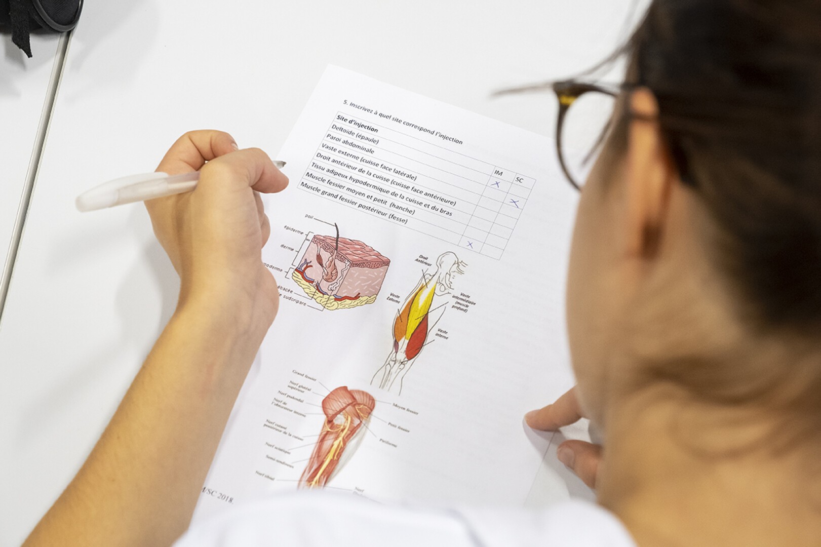 Une personne tenant un stylo étudie une feuille de travail d'anatomie imprimée comportant des schémas de muscles et de couches de peau, avec des parties étiquetées et un tableau répertoriant les symptômes et les critères de diagnostic.
